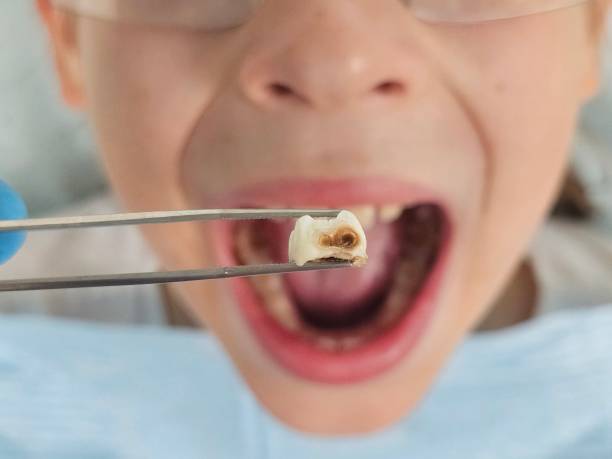 Emergency Dentist Open Today in WA